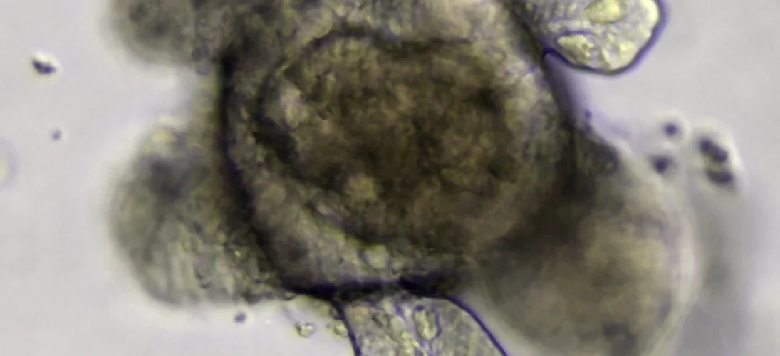 Organoïde intestinal cultivé à partir de cellules souches Lgr5+.