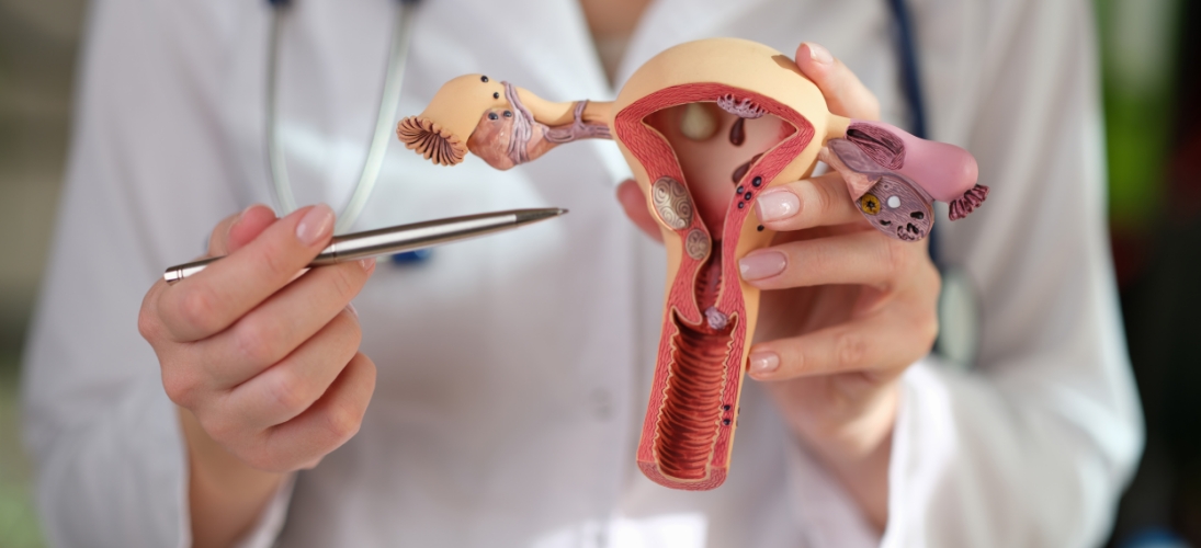 Cancer de l’ovaire : la recherche avance, la prise en charge aussi