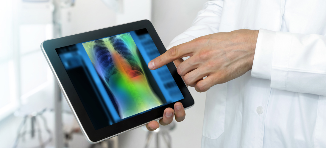 Radios et scanners dopés à l’intelligence artificielle